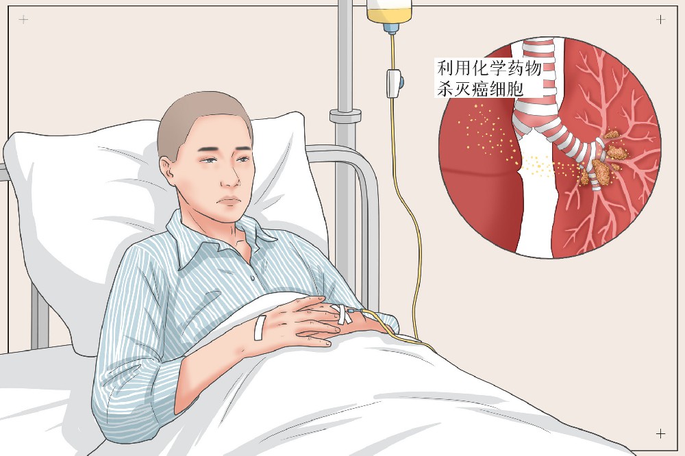 为什么有的人不抽烟反而得了肺癌呢？