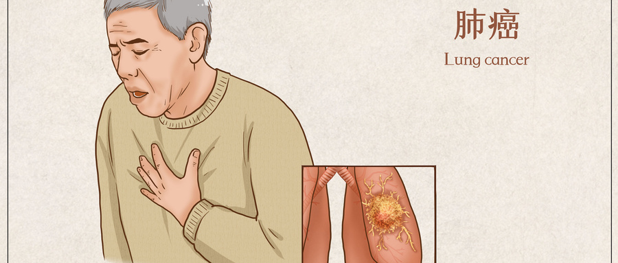 肿瘤患者喝中药后咳痰变多?普济中医:别慌!可能是身体在 “排毒” 肿瘤患者喝中药后咳痰变多?普济中医:别慌!可能是身体在 “排毒”