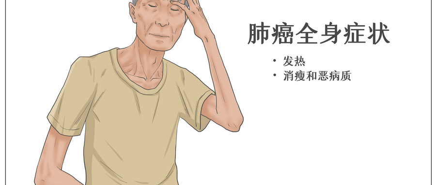 肿瘤病情恶化前，身体可能发出这 4 个 “预警信号”尤其第一个要警惕！