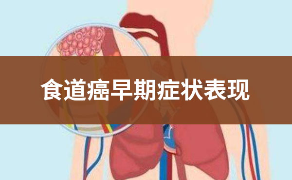 早期食道癌有哪些异常表现？