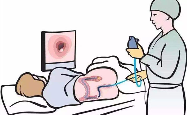 普济吴晓玲谈：结肠癌该如何检查